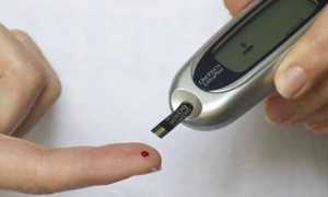 diabete modificato 1