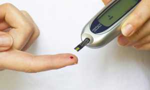 sangue diabete esame