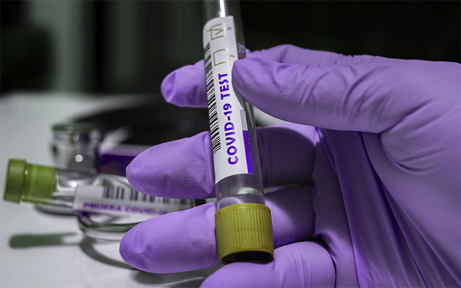 covid test viola images articles vco ossola 2022 febbraio thumb medium650 0